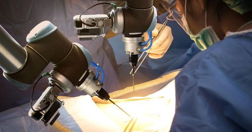 醫療器械開發的自動化浪潮 驅動大型醫療器械自動化的核心原因